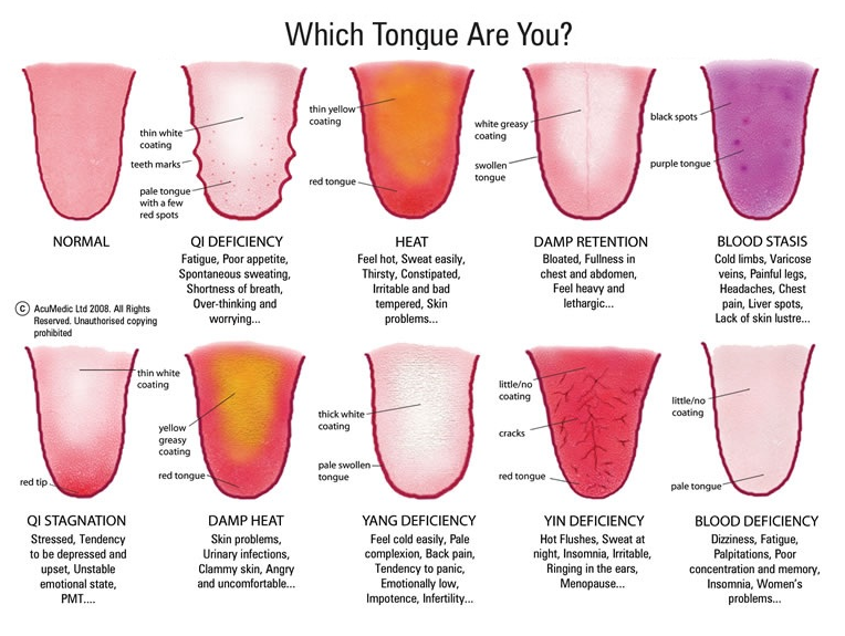 TCM Tongue diagnosis 4.png