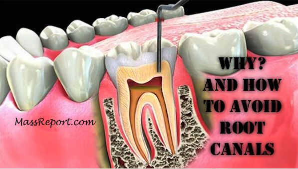 The Dangerous Truth About Root Canals.png